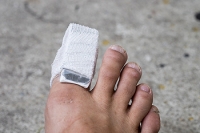 A Common Method of Treating a Broken Toe